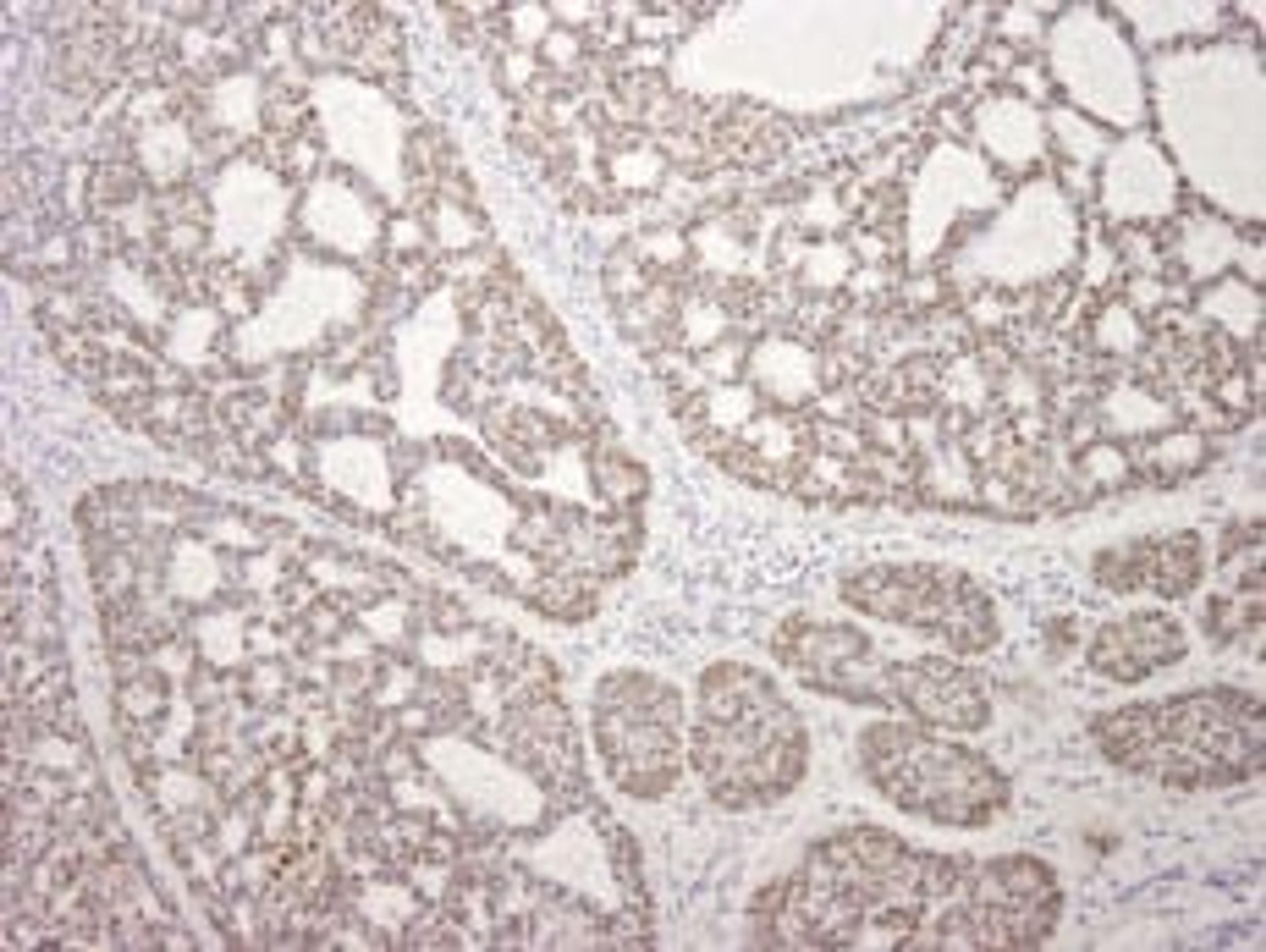 Detection of human MDC1 by immunohistochemistry.