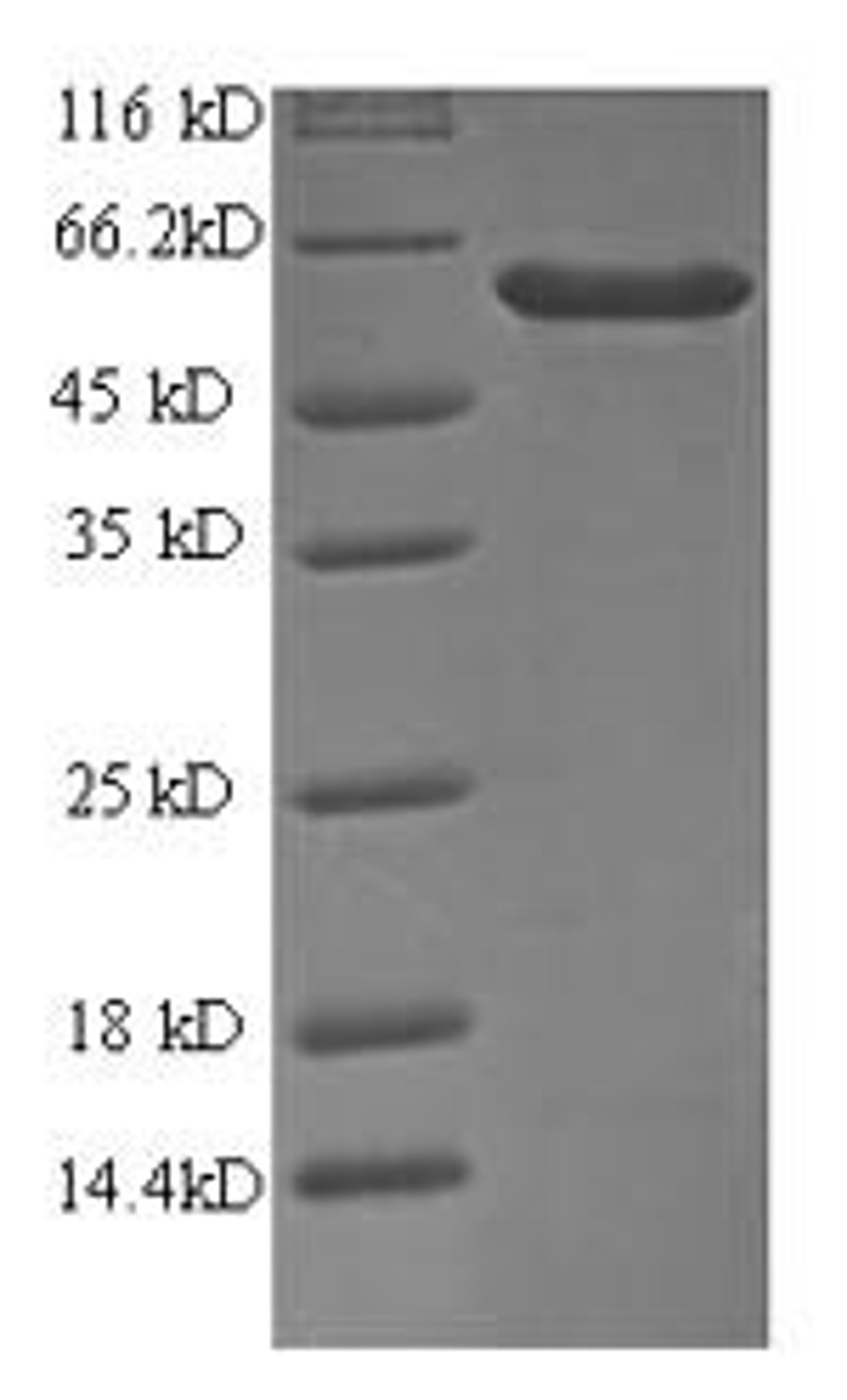 (Tris-Glycine gel) Discontinuous SDS-PAGE (reduced) with 5% enrichment gel and 15% separation gel.