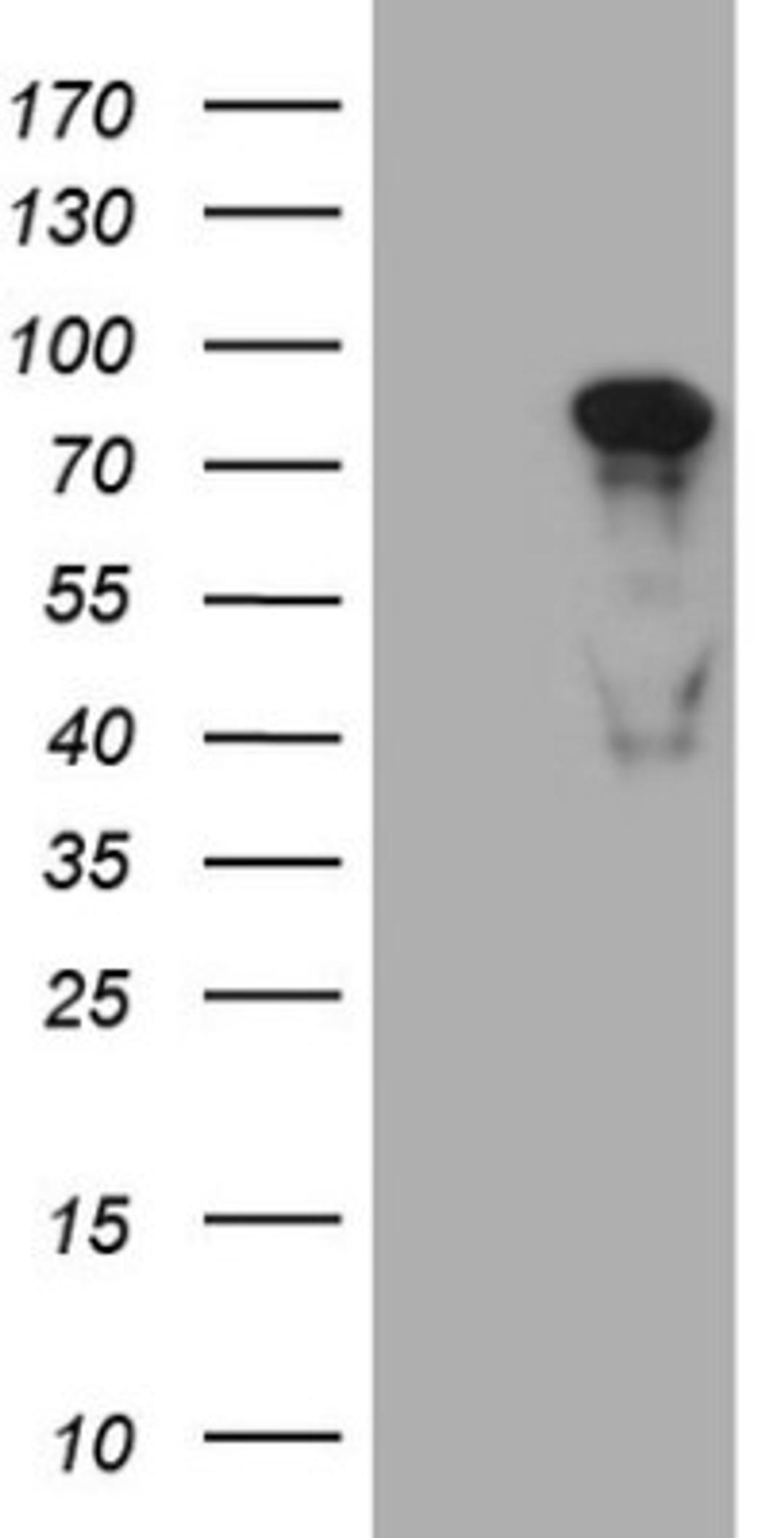 Western Blot: MED15 Antibody (1C11) [NBP2-45780] - Analysis of HEK293T cells were transfected with the pCMV6-ENTRY control (Left lane) or pCMV6-ENTRY MED15.