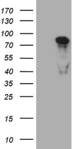 Western Blot: MED15 Antibody (1C11) [NBP2-45780] - Analysis of HEK293T cells were transfected with the pCMV6-ENTRY control (Left lane) or pCMV6-ENTRY MED15.