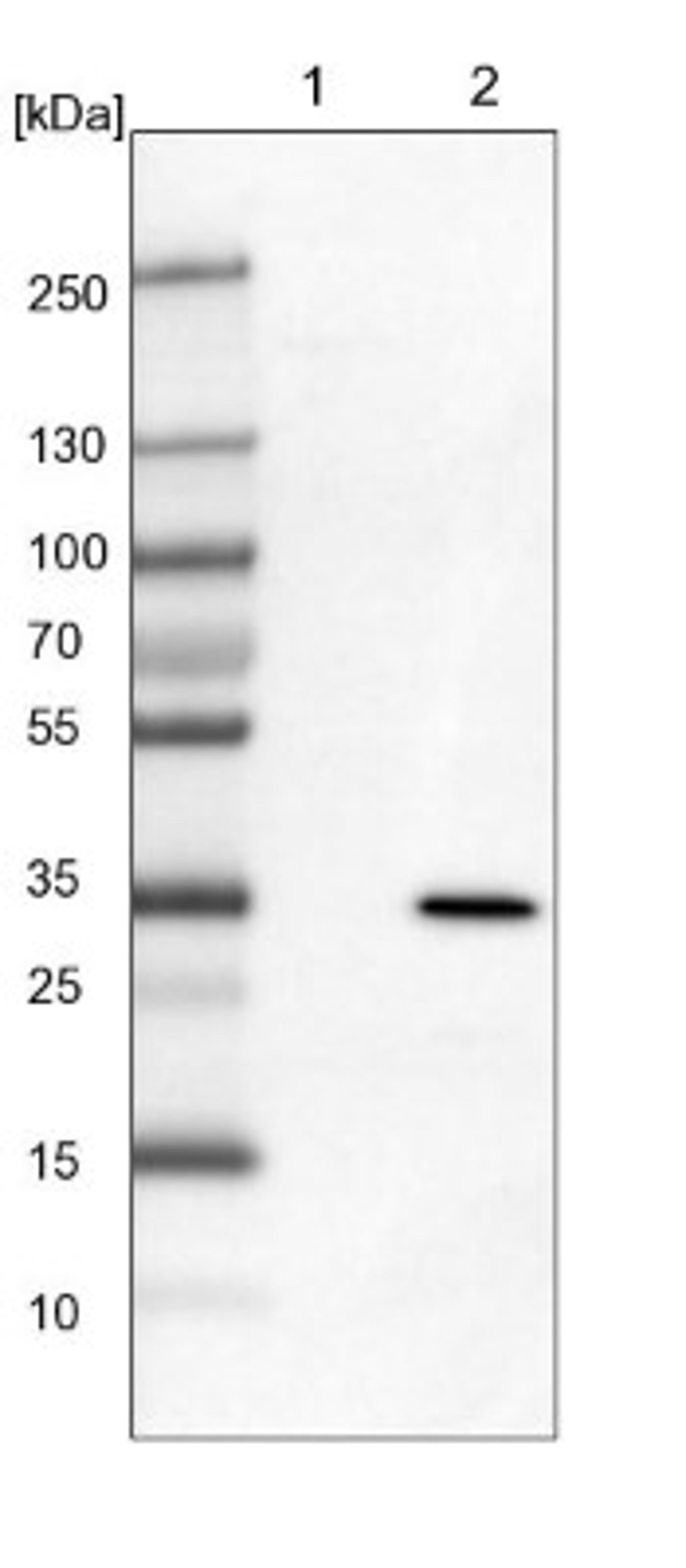 Western Blot: MRG15 Antibody [NBP1-84937] - Lane 1: Mouse liver tissue lysate<br/>Lane 2: Rat liver tissue lysate