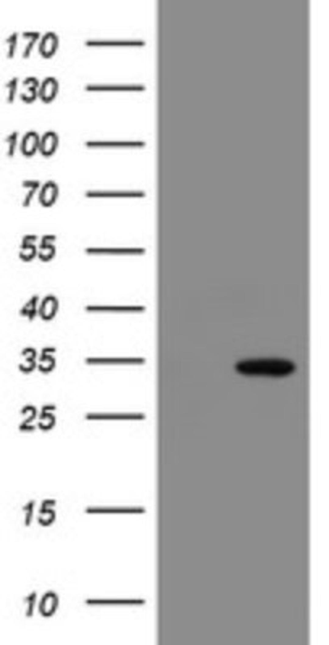 Western Blot: SLA2 Antibody (3A7) [NBP2-45867] - Analysis of HEK293T cells were transfected with the pCMV6-ENTRY control (Left lane) or pCMV6-ENTRY SLA2.