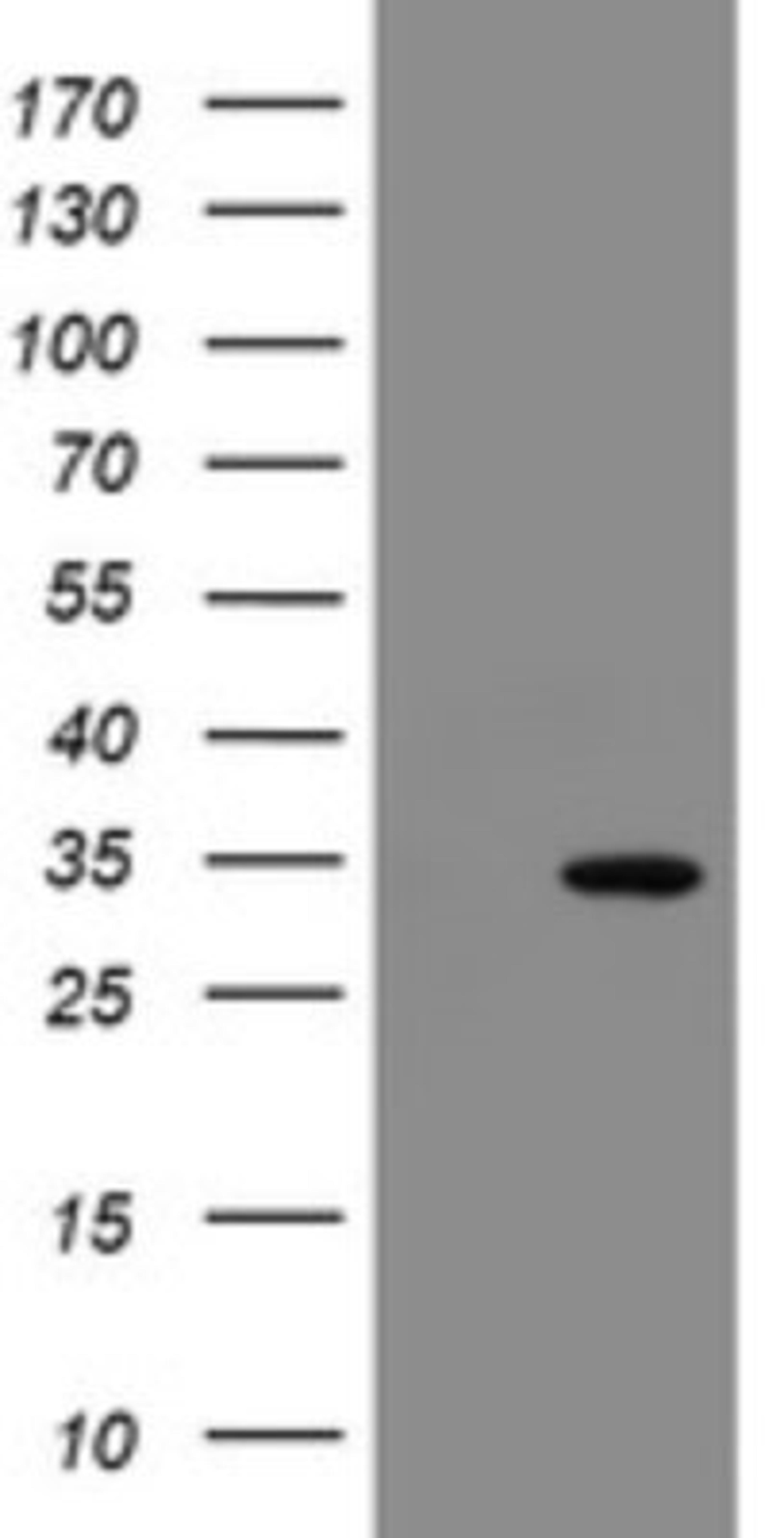 Western Blot: SLA2 Antibody (3A7) [NBP2-45867] - Analysis of HEK293T cells were transfected with the pCMV6-ENTRY control (Left lane) or pCMV6-ENTRY SLA2.