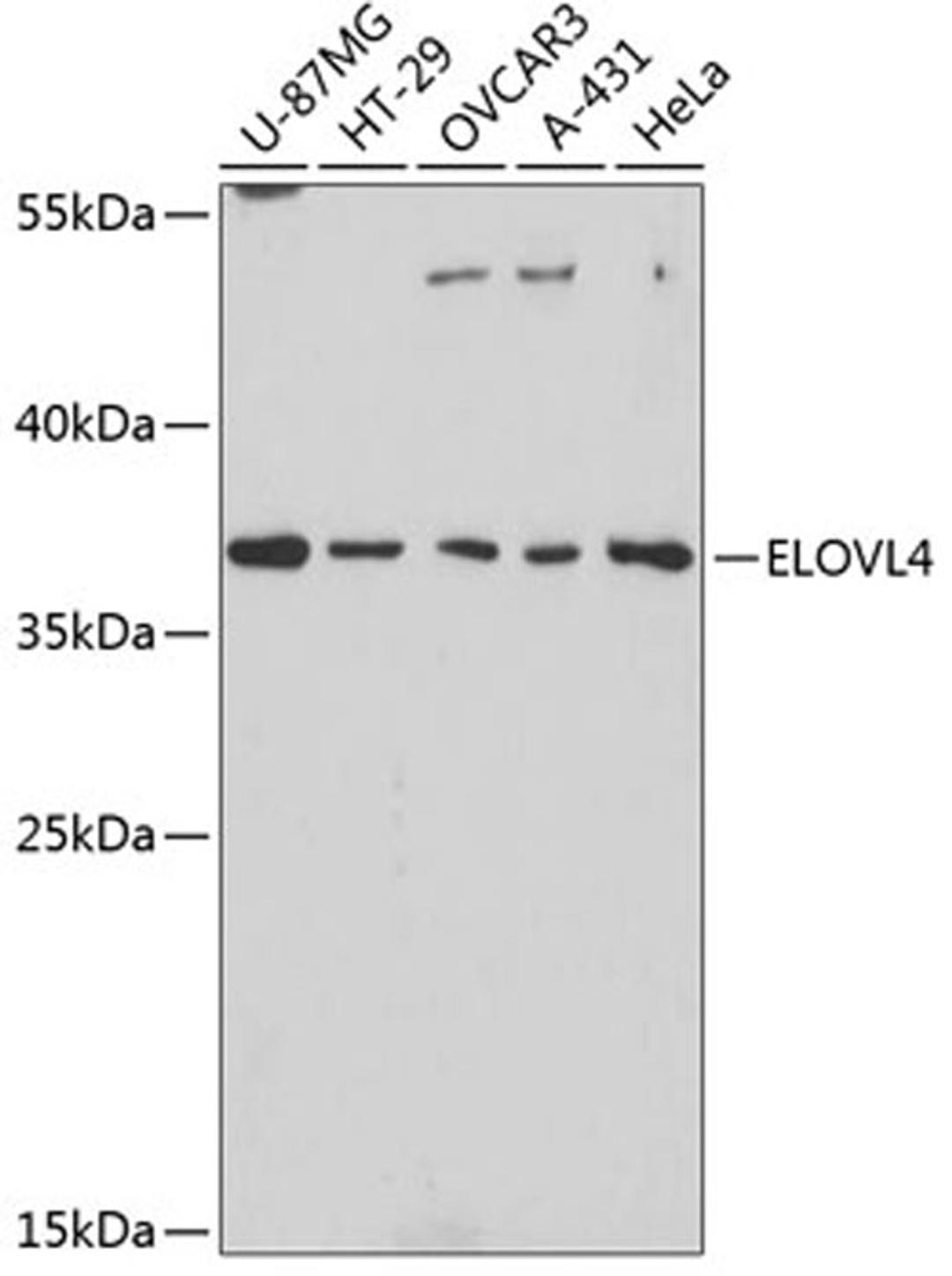 Western blot - ELOVL4 antibody (A3639)
