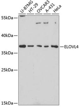 Western blot - ELOVL4 antibody (A3639)