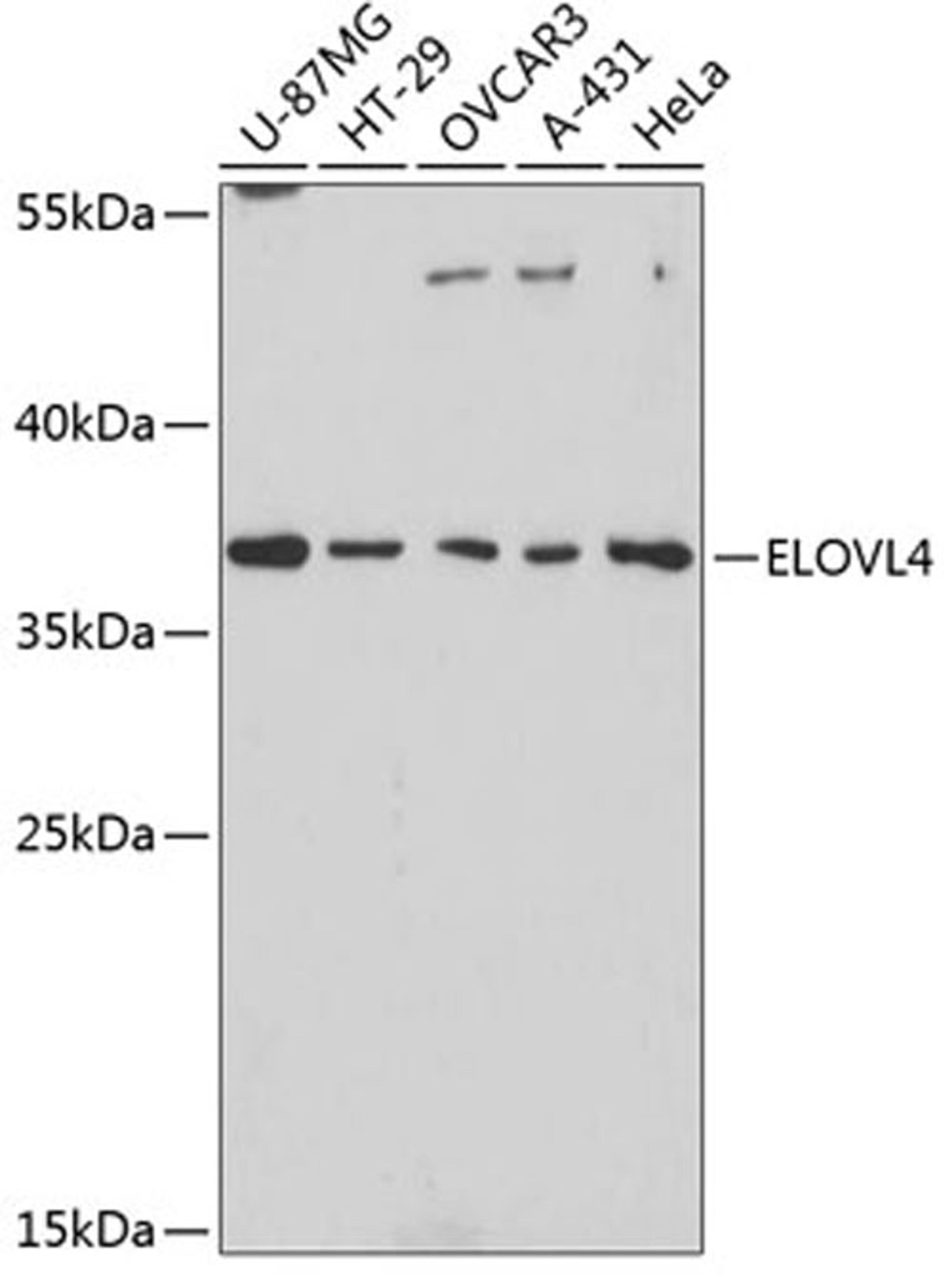 Western blot - ELOVL4 antibody (A3639)
