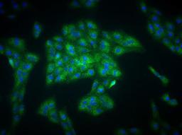 Immunocytochemistry/Immunofluorescence: EGLN1/PHD2 Antibody [NB100-2219] - analysis of PHD2 in ARPE-19 cells using anti-PHD2 antibody. Image from veriifed customer review.