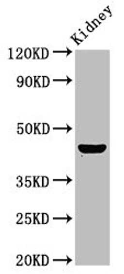 Western Blot. Positive WB detected in: Rat kidney tissue. All lanes: PBX1 antibody at 4.7ug/ml. Secondary. Goat polyclonal to rabbit IgG at 1/50000 dilution. Predicted band size: 47, 39 kDa. Observed band size: 47 kDa.