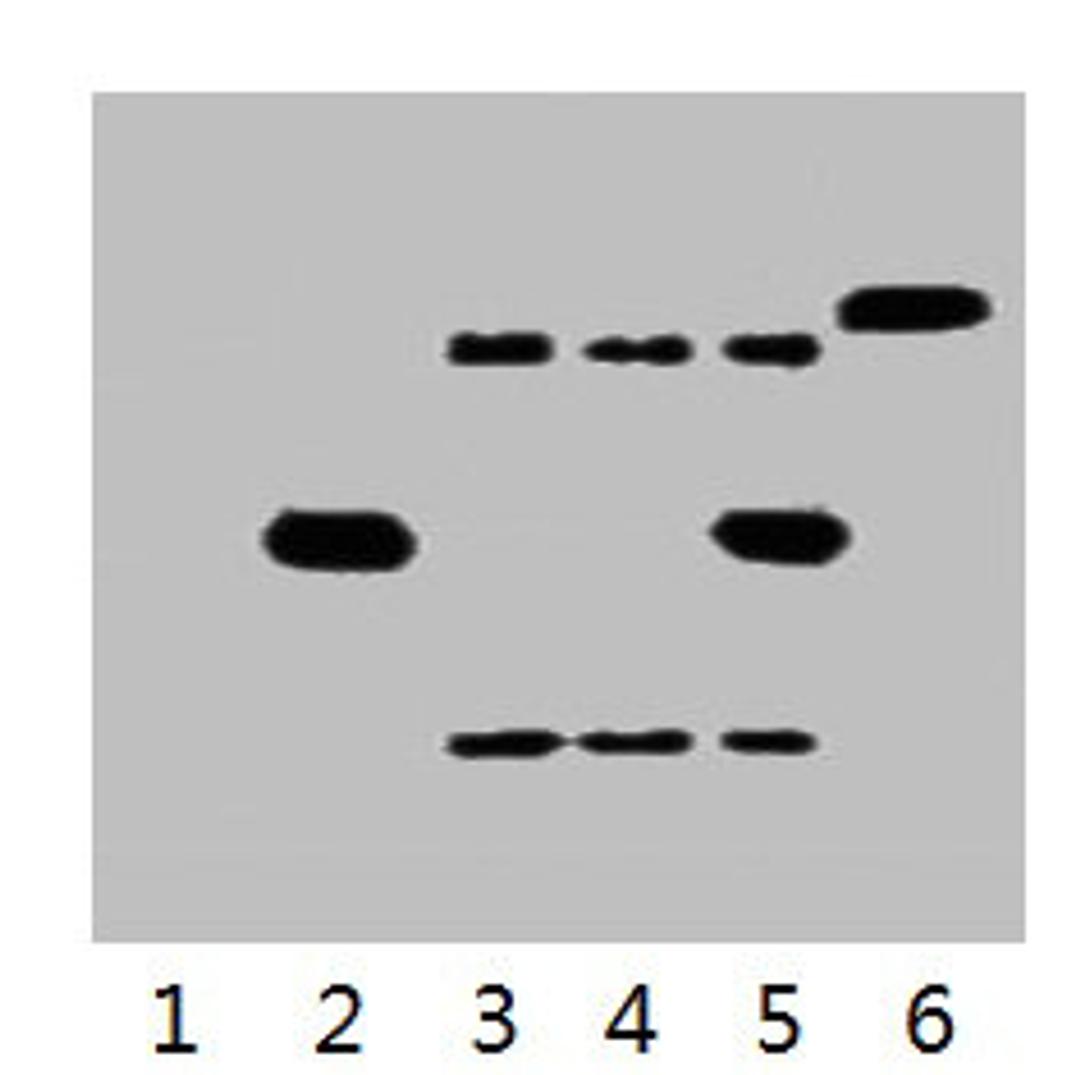 IP antibody use: 5µg His Mouse IgG1 per ml Lysate, WB 1:3000. Lane 1: untransfected 293 cell lysate. Lane 2: transfected 293 cell lysate with His-tag fusion protein. Lane 3: IP (untransfected 293 + anti-His mAb + Protein G agarose). Lane 4: IP (transfected 293 + normal Mouse IgG + Protein G agarose). Lane 5: IP (transfected 293 + anti-His mAb + Protein G agarose). Lane 6: Recombinant protein (E.coli).