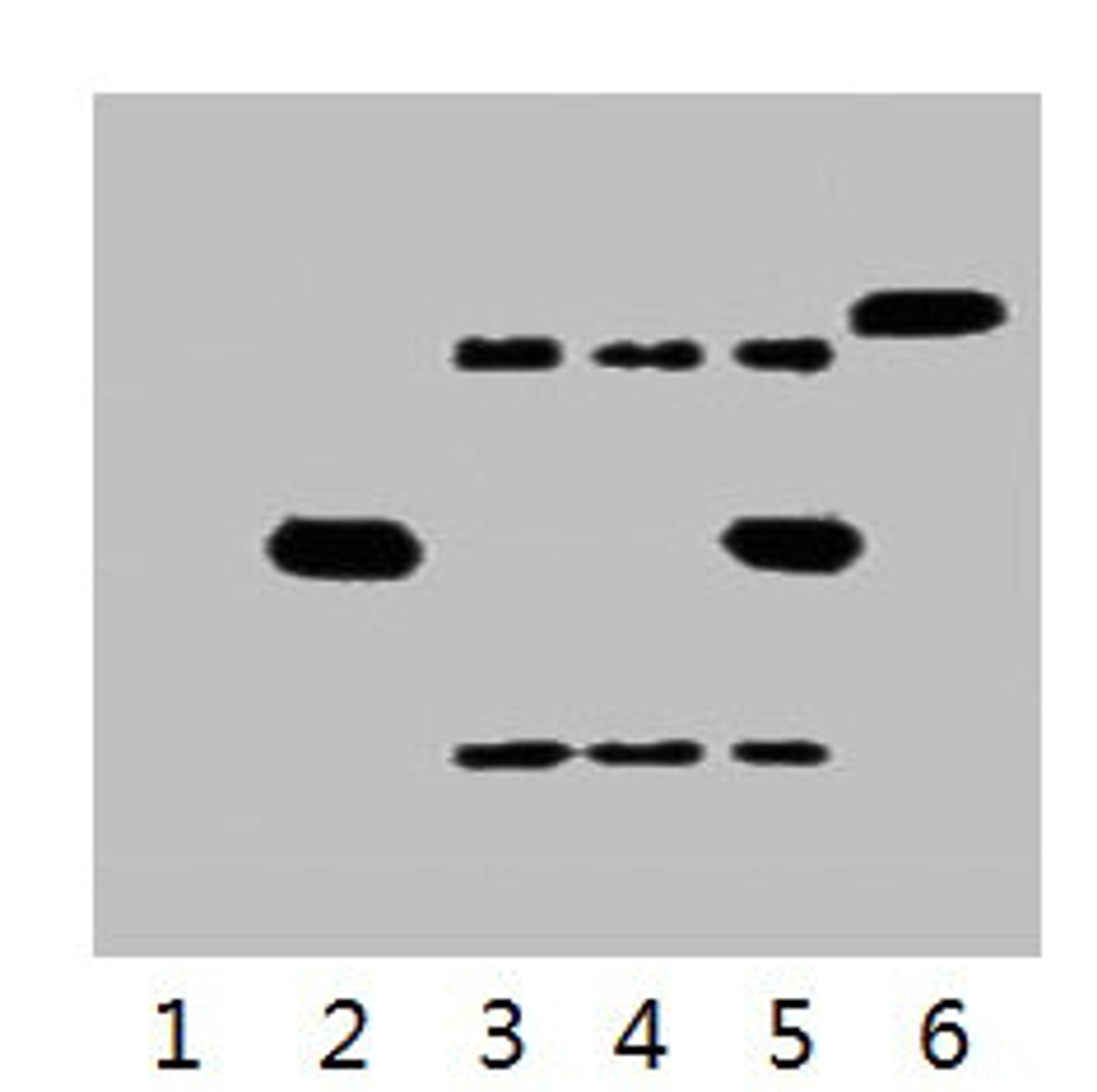 IP antibody use: 5µg His Mouse IgG1 per ml Lysate, WB 1:3000. Lane 1: untransfected 293 cell lysate. Lane 2: transfected 293 cell lysate with His-tag fusion protein. Lane 3: IP (untransfected 293 + anti-His mAb + Protein G agarose). Lane 4: IP (transfected 293 + normal Mouse IgG + Protein G agarose). Lane 5: IP (transfected 293 + anti-His mAb + Protein G agarose). Lane 6: Recombinant protein (E.coli).