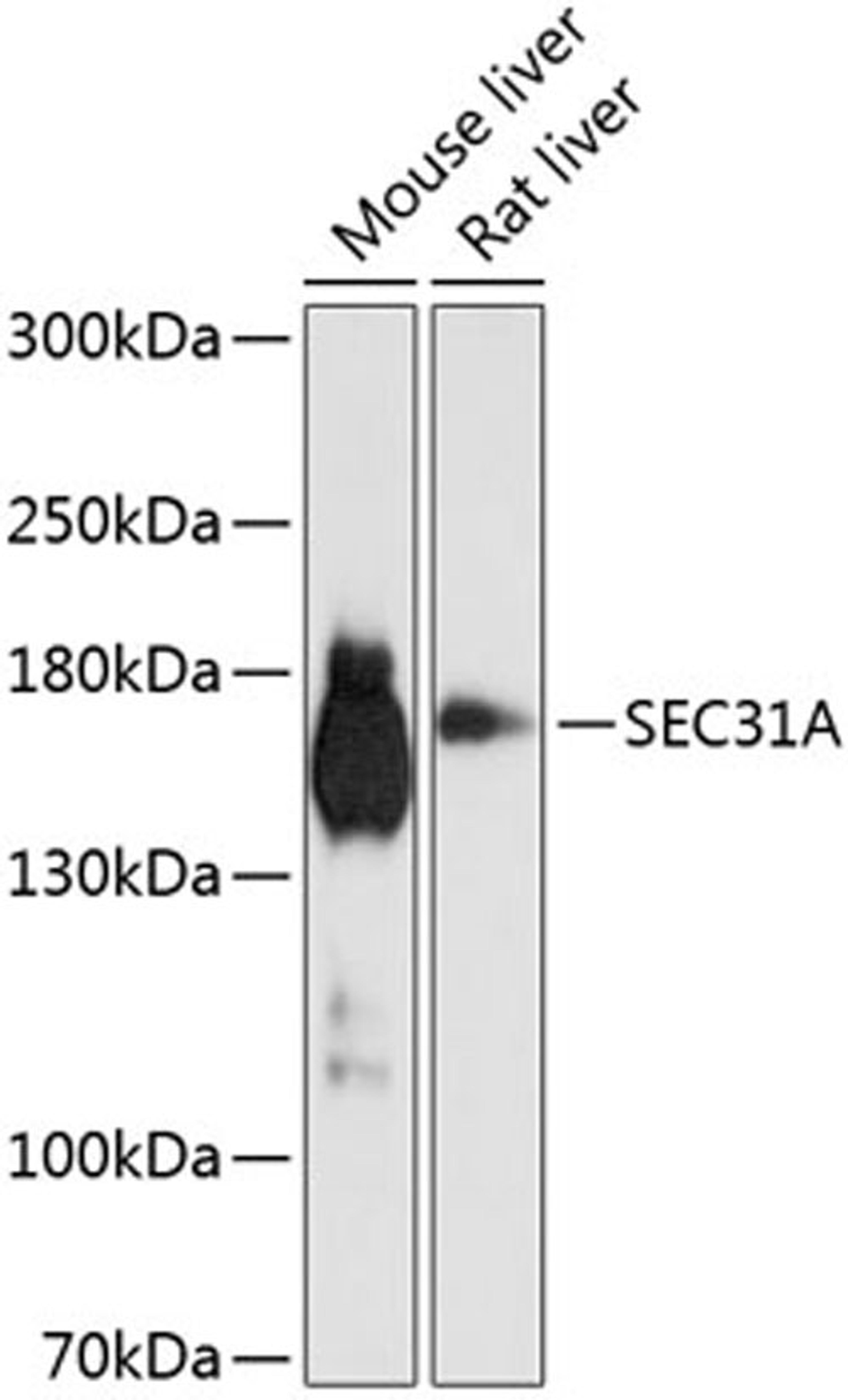 Western blot - SEC31A antibody (A9321)