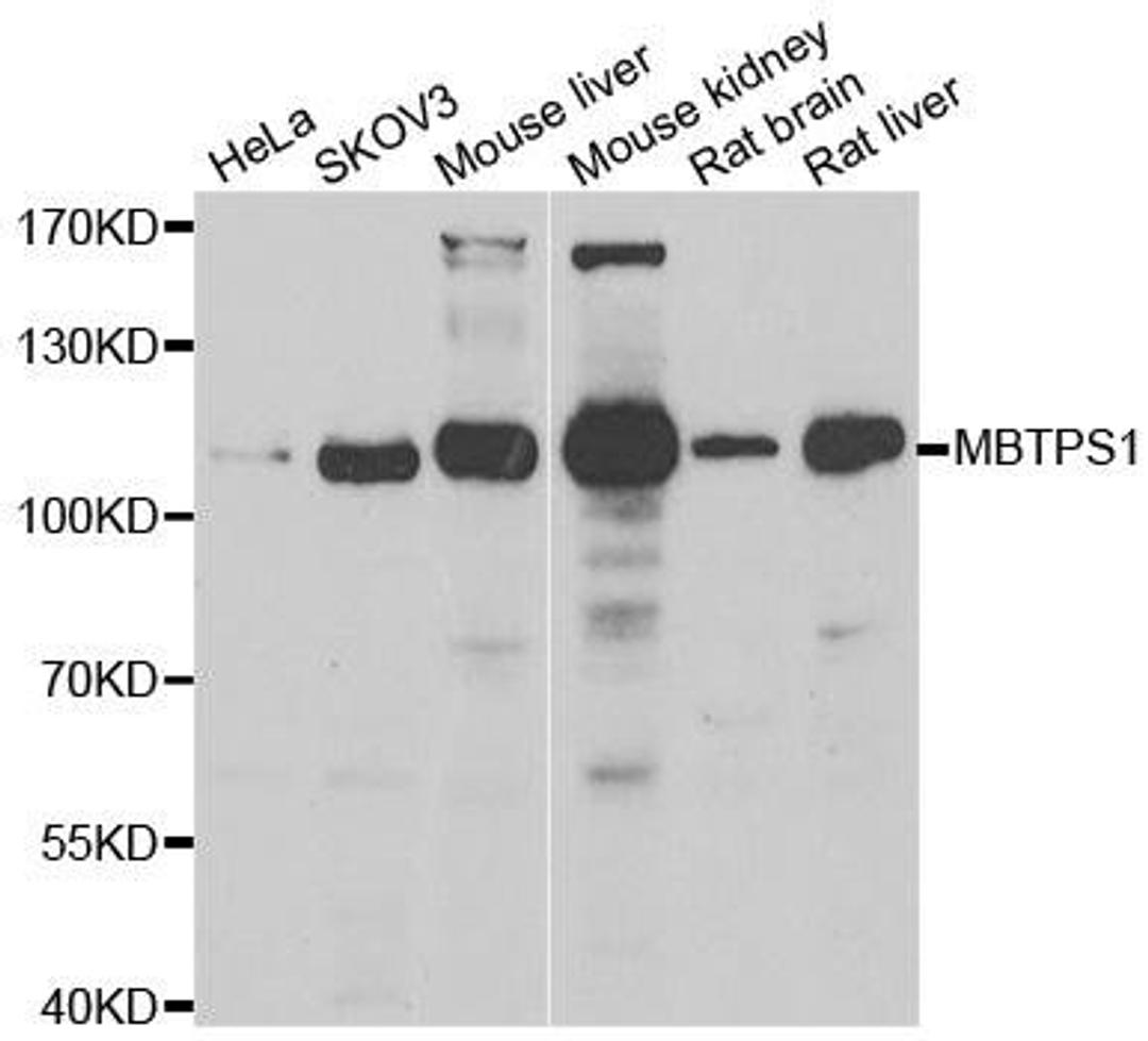 Western blot analysis of extracts of various cell lines using MBTPS1 antibody