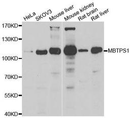 Western blot analysis of extracts of various cell lines using MBTPS1 antibody