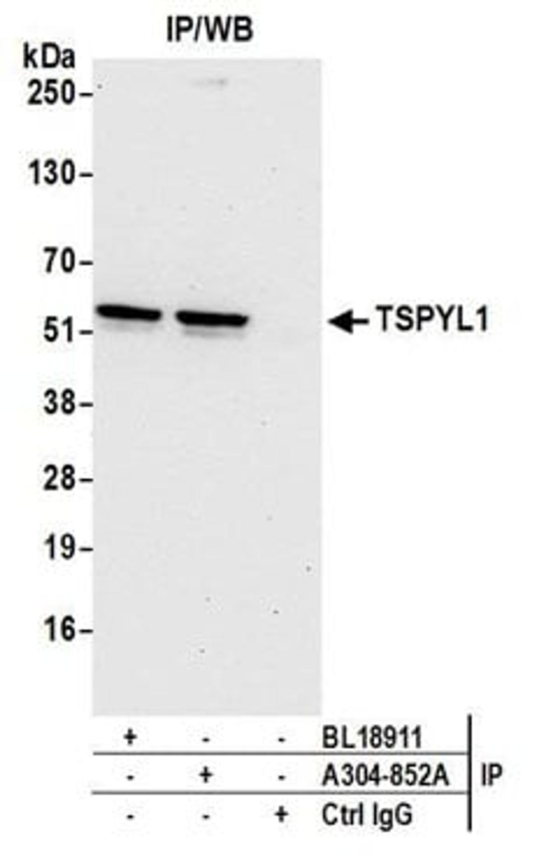 Detection of human TSPYL1 by western blot of immunoprecipitates.