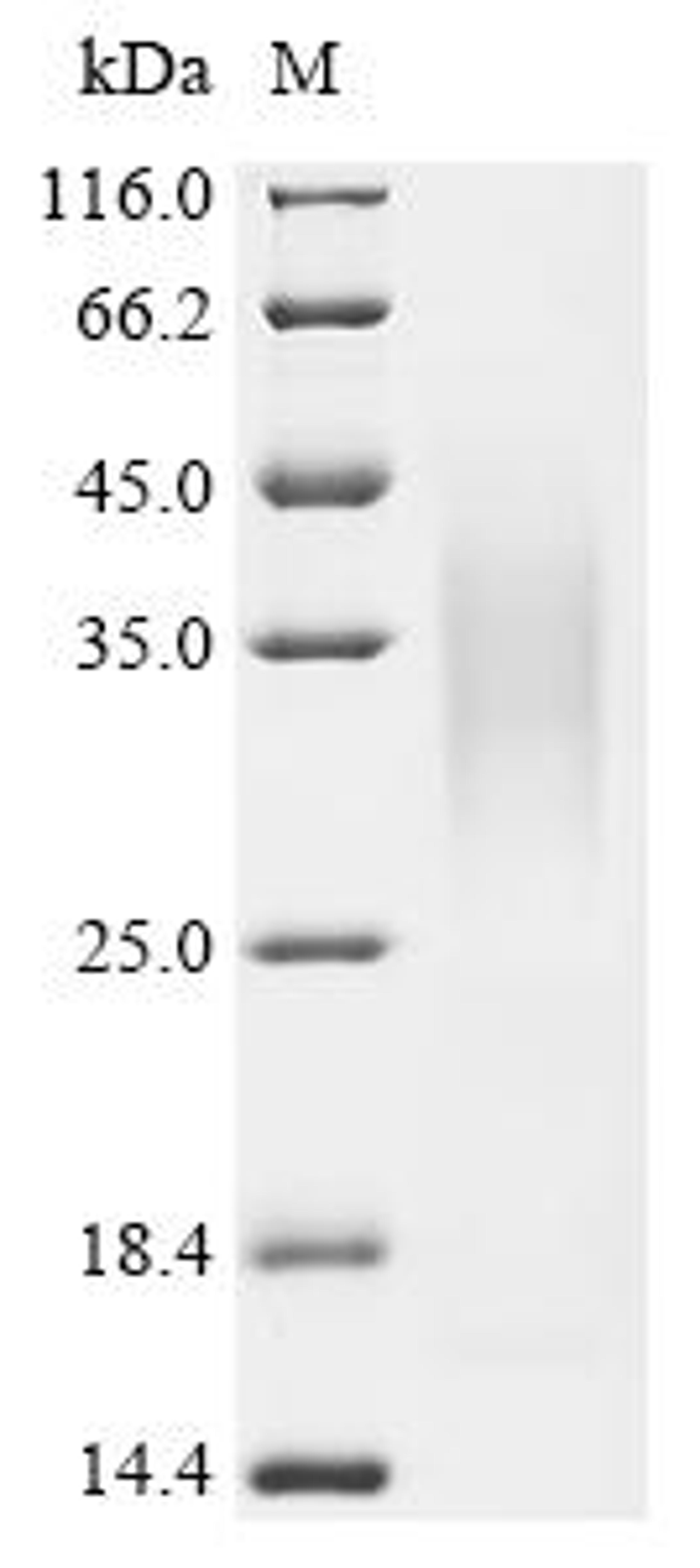 (Tris-Glycine gel) Discontinuous SDS-PAGE (reduced) with 5% enrichment gel and 15% separation gel.