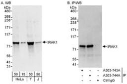 Detection of human IRAK1 by western blot and immunoprecipitation.