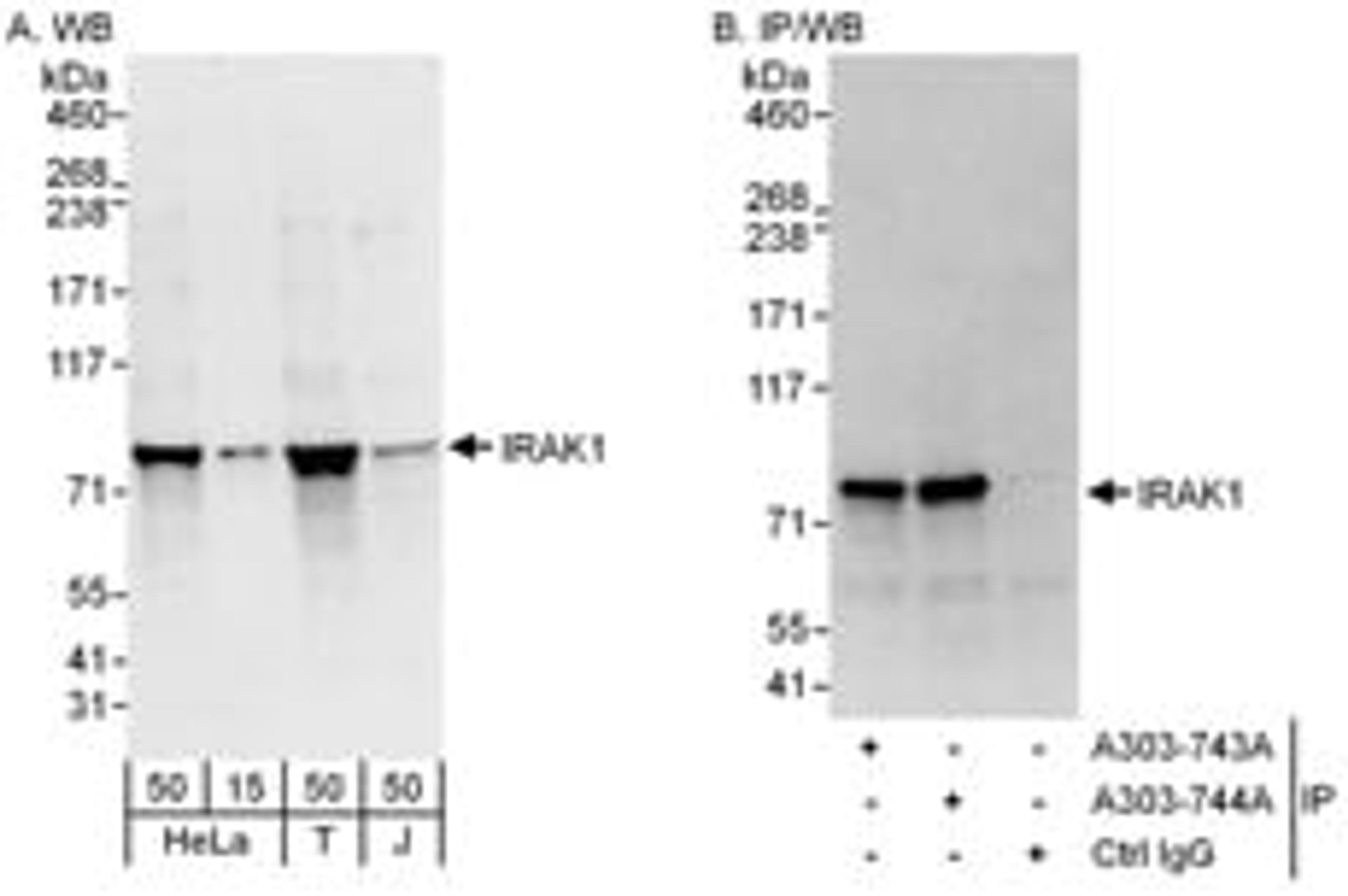 Detection of human IRAK1 by western blot and immunoprecipitation.