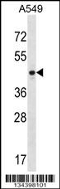 Western blot analysis in A549 cell line lysates (35ug/lane).