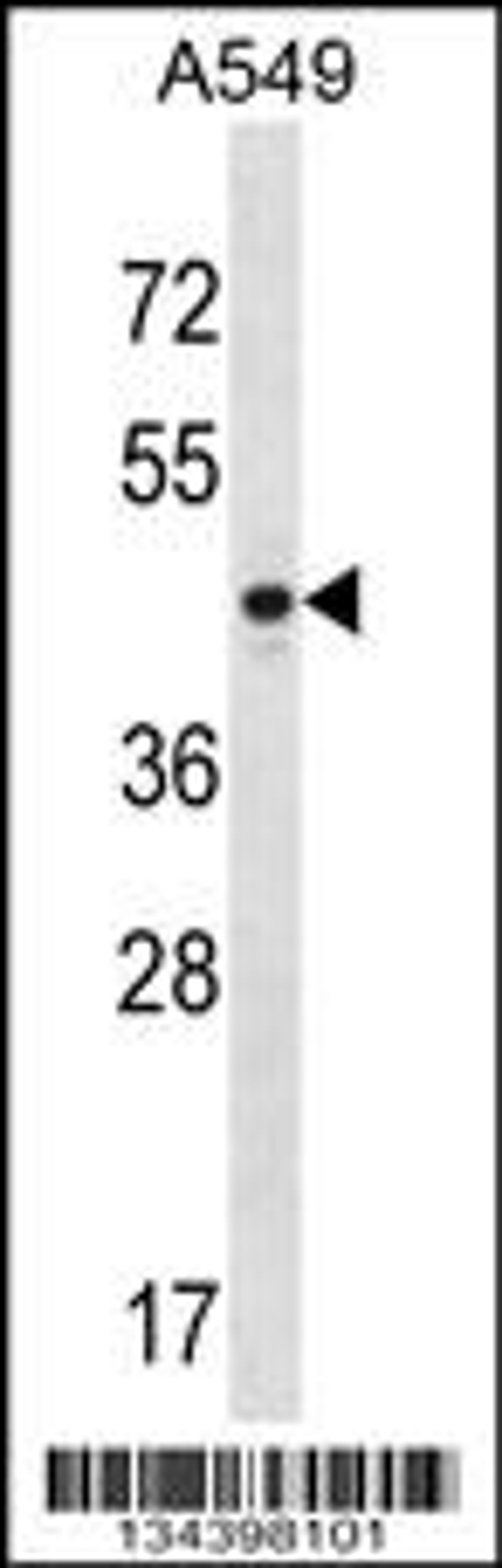 Western blot analysis in A549 cell line lysates (35ug/lane).