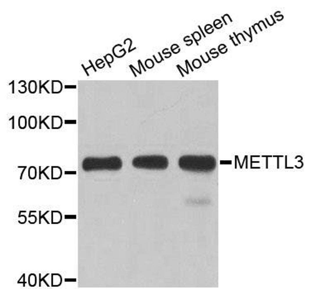 Western blot analysis of extracts of various cell lines using METTL3 antibody