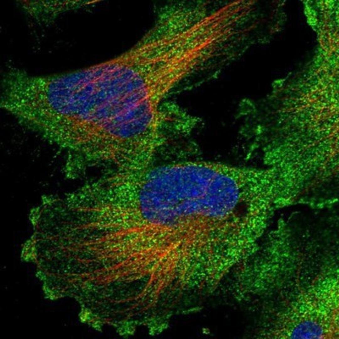 Immunocytochemistry/Immunofluorescence: RASSF3 Antibody [NBP1-89425] - Staining of human cell line U-251 MG shows positivity in plasma membrane & cytoplasm.