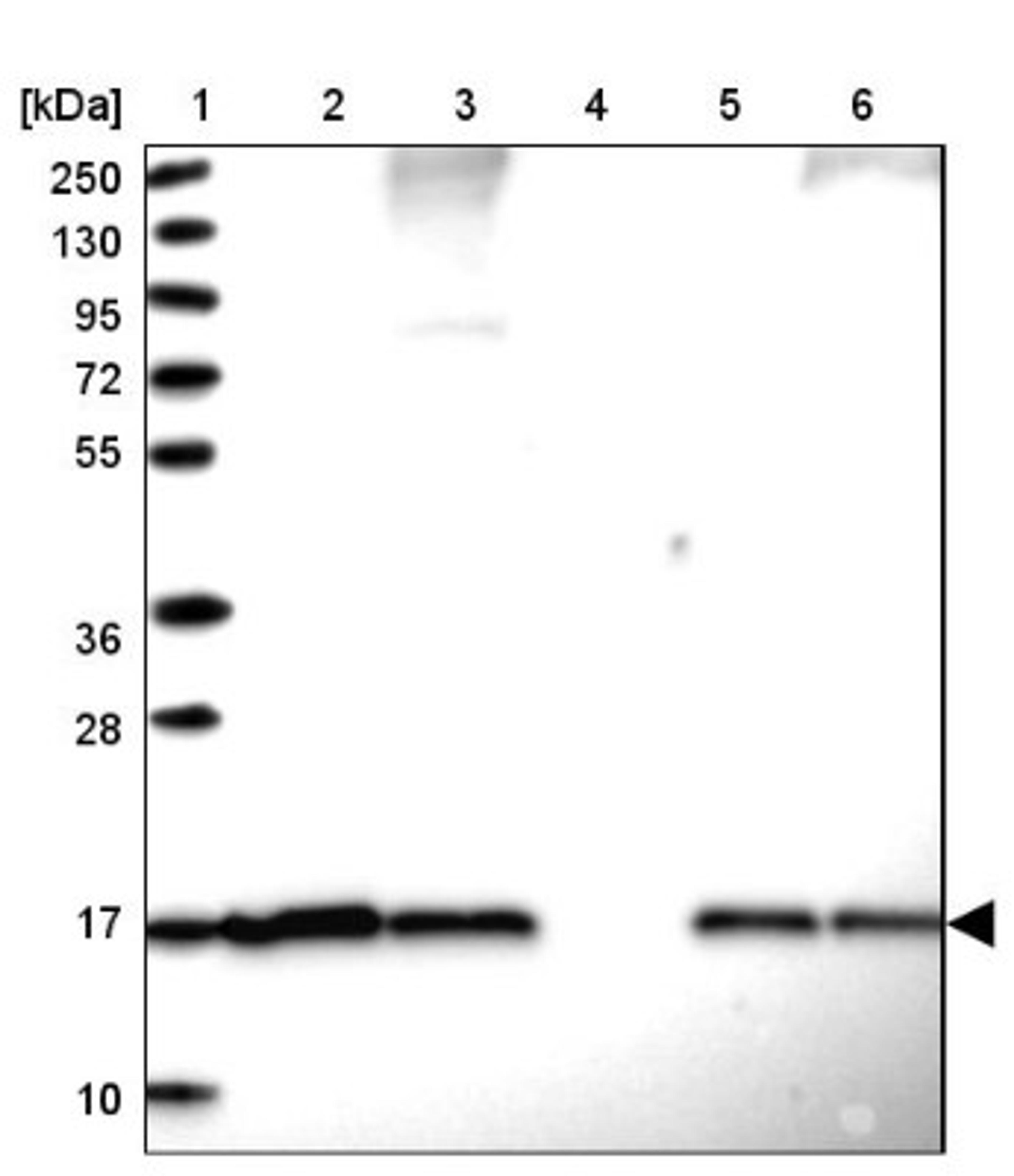 Western Blot: SUMO4 Antibody [NBP2-34073] - Lane 1: Marker [kDa] 250, 130, 95, 72, 55, 36, 28, 17, 10<br/>Lane 2: Human cell line RT-4<br/>Lane 3: Human cell line U-251MG sp<br/>Lane 4: Human plasma (IgG/HSA depleted)<br/>Lane 5: Human liver tissue<br/>Lane 6: Human tonsil tissue