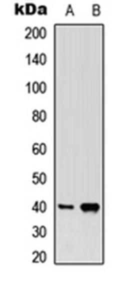 Western blot analysis of HEK293T (Lane 1), NIH3T3 (Lane 2) whole cell lysates using PGD2 Receptor antibody