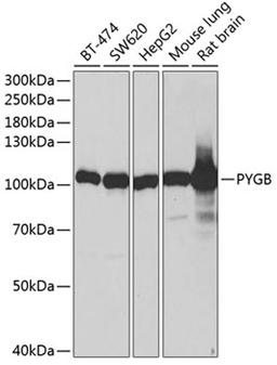 Western blot - PYGB antibody (A13539)