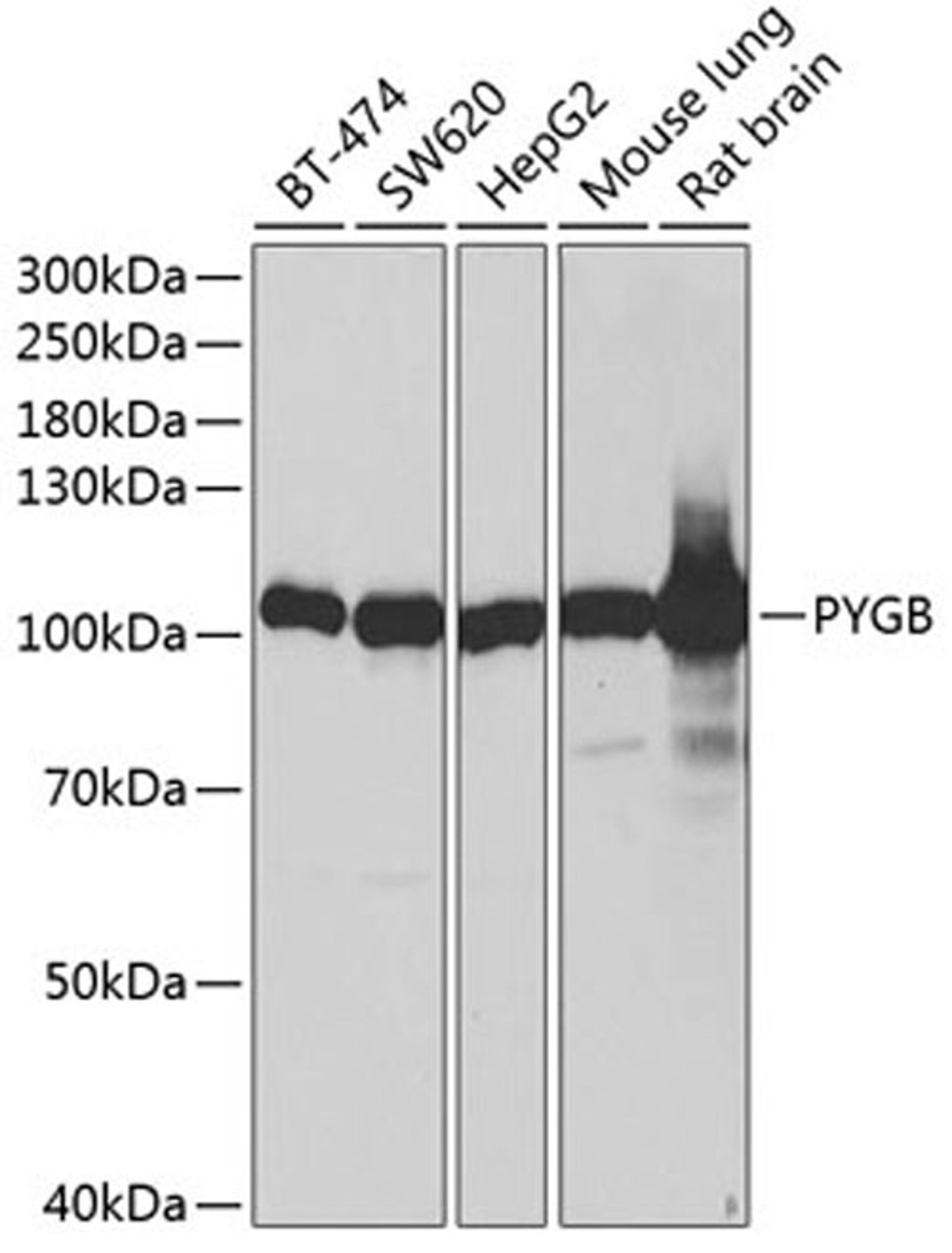 Western blot - PYGB antibody (A13539)