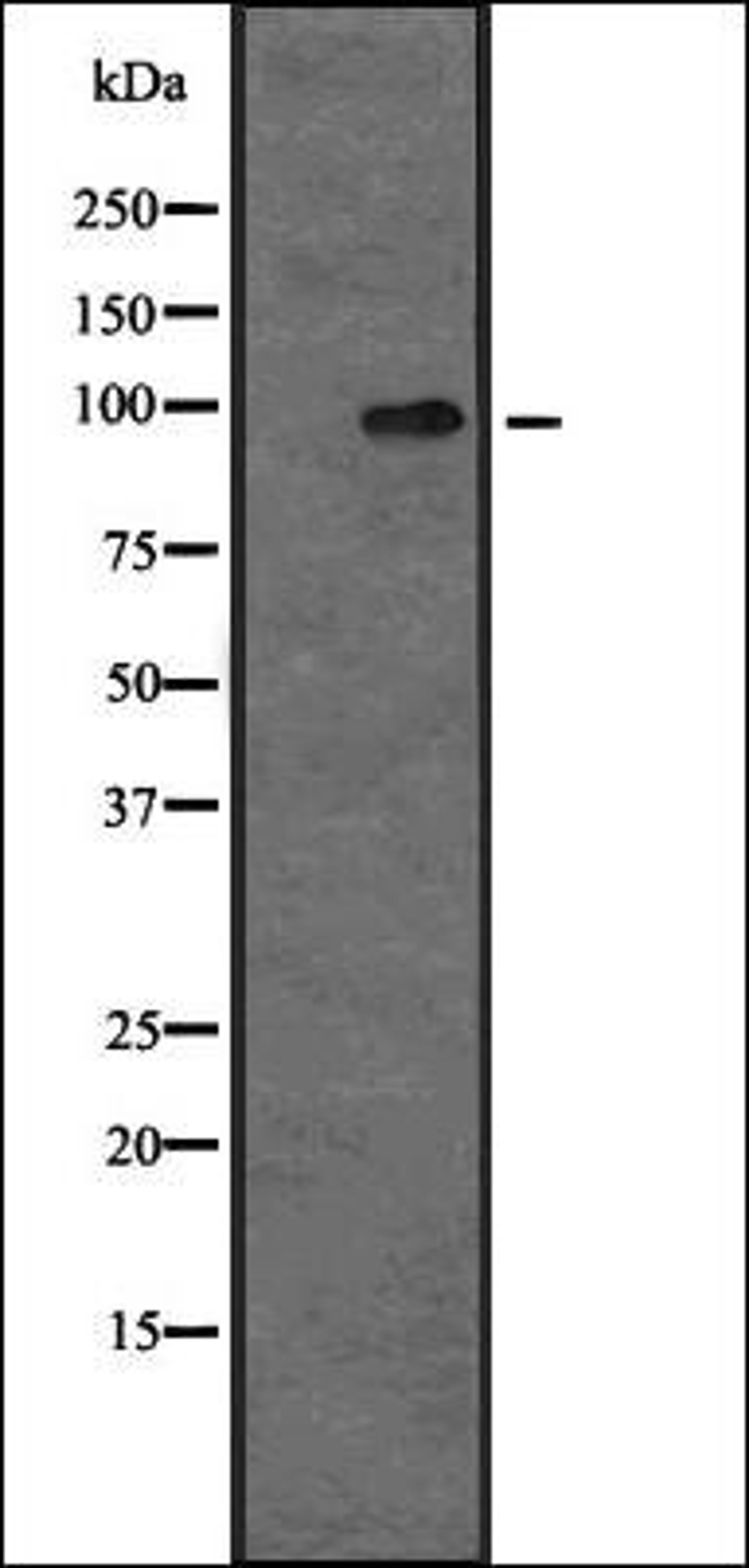 Western blot analysis of MOLT4 whole cell lysate using MAP4K5 antibody