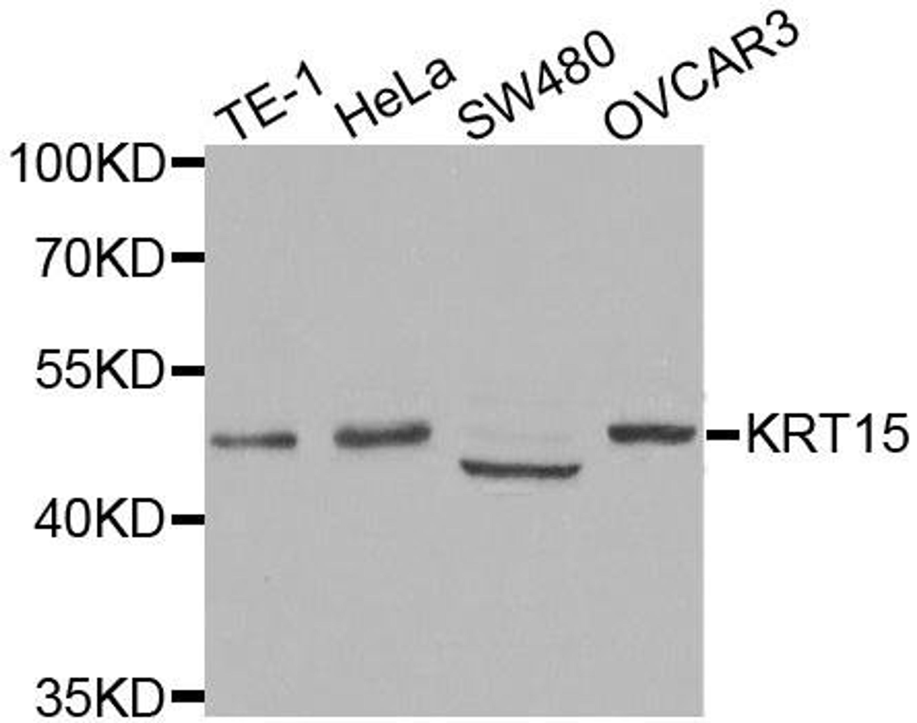 Western blot analysis of extracts of various cell lines using KRT15 antibody