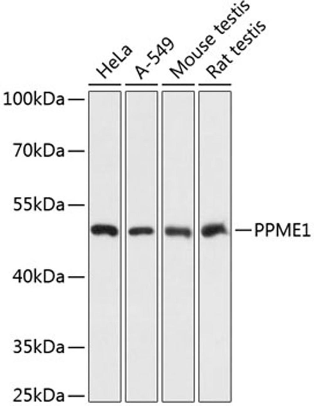 Western blot - PPME1 antibody (A13094)