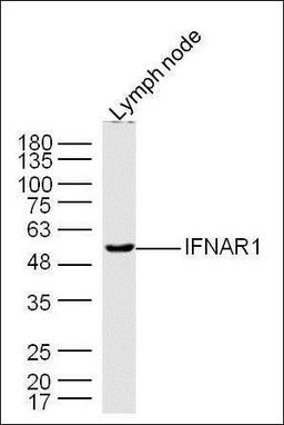 Western blot analysis of extracts from Lymph node tissue(mo) using IFNAR1 antibody.. 