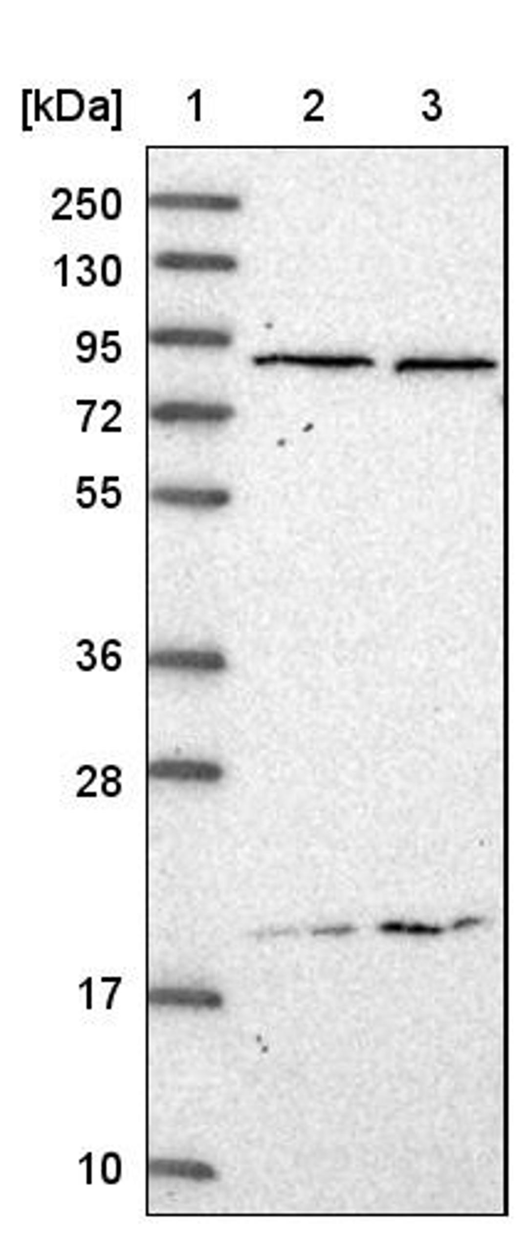 Western Blot: C20orf62 Antibody [NBP1-94085] - Lane 1: Marker [kDa] 250, 130, 95, 72, 55, 36, 28, 17, 10<br/>Lane 2: Human cell line RT-4<br/>Lane 3: Human cell line U-251MG sp