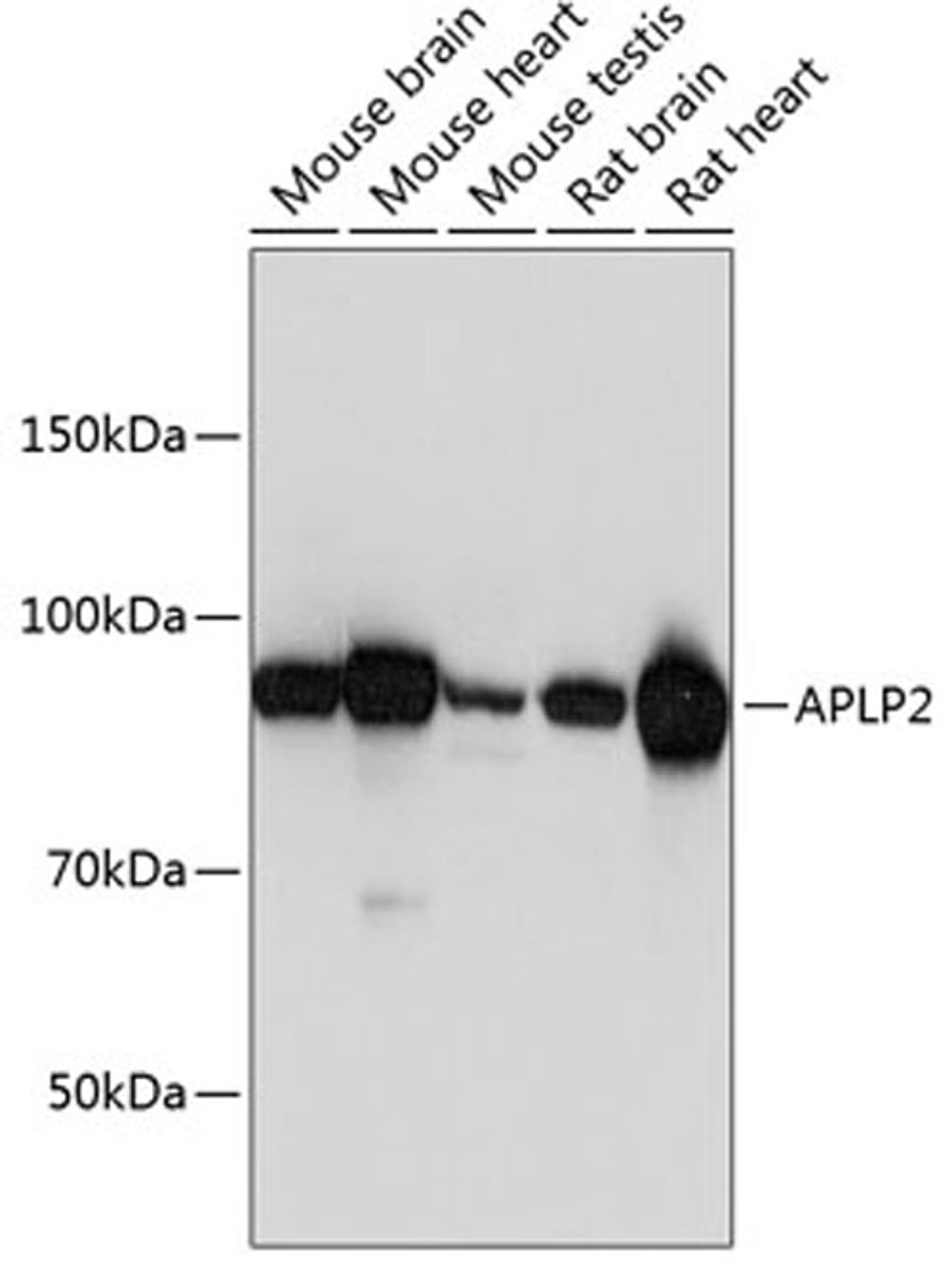 Western blot - APLP2 Polyclonal Antibody (A5455)