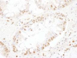 Detection of human SNRNP200 by immunohistochemistry.