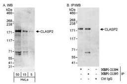 Western Blot: CLASP2 Antibody [NBP1-21395] - Whole cell lysate (5, 15 and 50  mcg for WB; 1 mg for IP, 20% of IP loaded) from HeLa cells.   Affinity purified rabbit anti-CLASP2 antibody   used for WB at 0.1 mcg/ml (A) and 0.4 mcg/ml (B)  and used for IP at 3 mcg/mg lysate. CLASP2 was also  immunoprecipitated by rabbit anti-CLASP2 antibody  NBP1-21394, which recognizes an upstream epitope