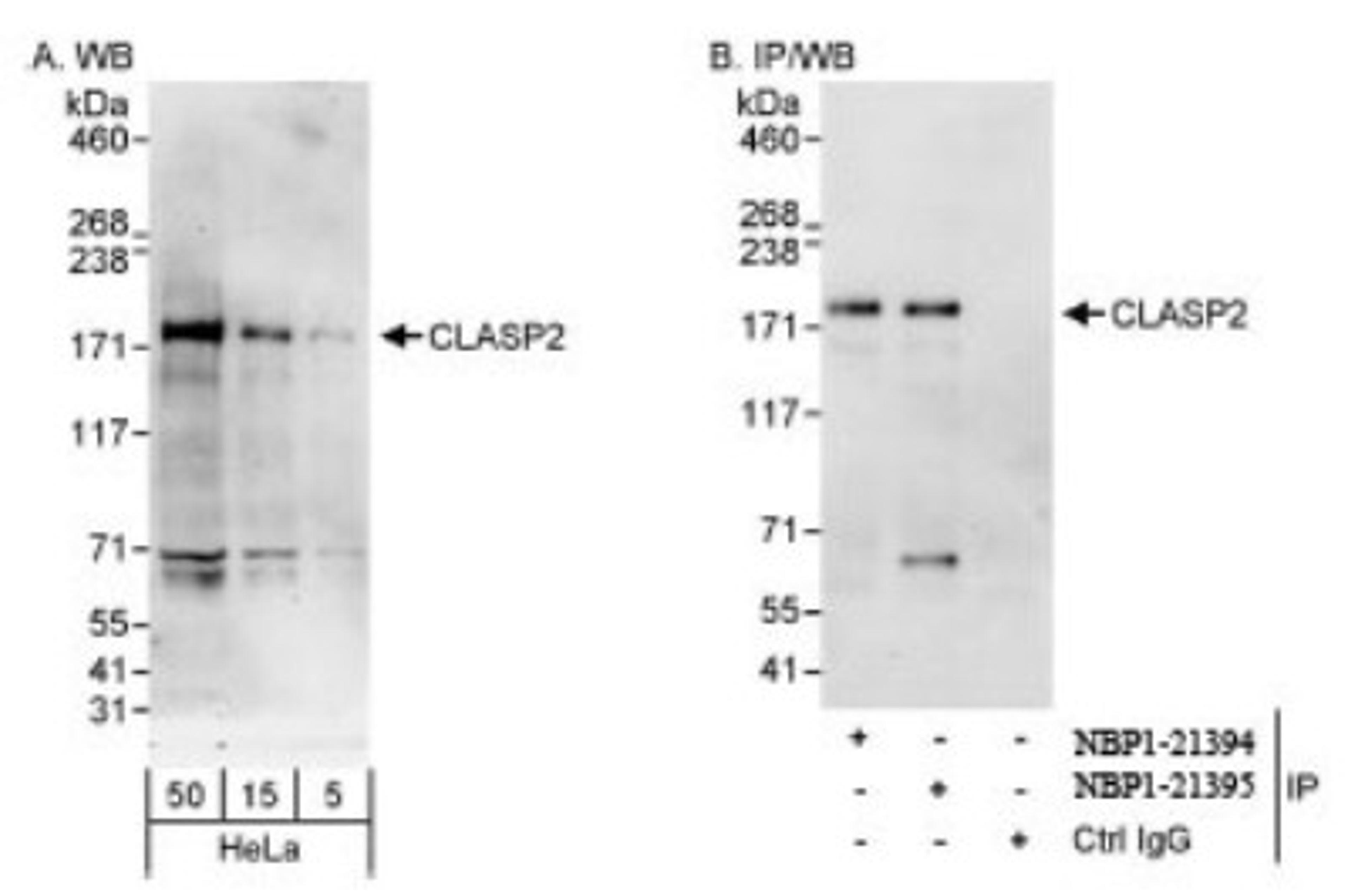 Western Blot: CLASP2 Antibody [NBP1-21395] - Whole cell lysate (5, 15 and 50  mcg for WB; 1 mg for IP, 20% of IP loaded) from HeLa cells.   Affinity purified rabbit anti-CLASP2 antibody   used for WB at 0.1 mcg/ml (A) and 0.4 mcg/ml (B)  and used for IP at 3 mcg/mg lysate. CLASP2 was also  immunoprecipitated by rabbit anti-CLASP2 antibody  NBP1-21394, which recognizes an upstream epitope