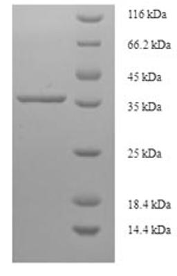 (Tris-Glycine gel) Discontinuous SDS-PAGE (reduced) with 5% enrichment gel and 15% separation gel.