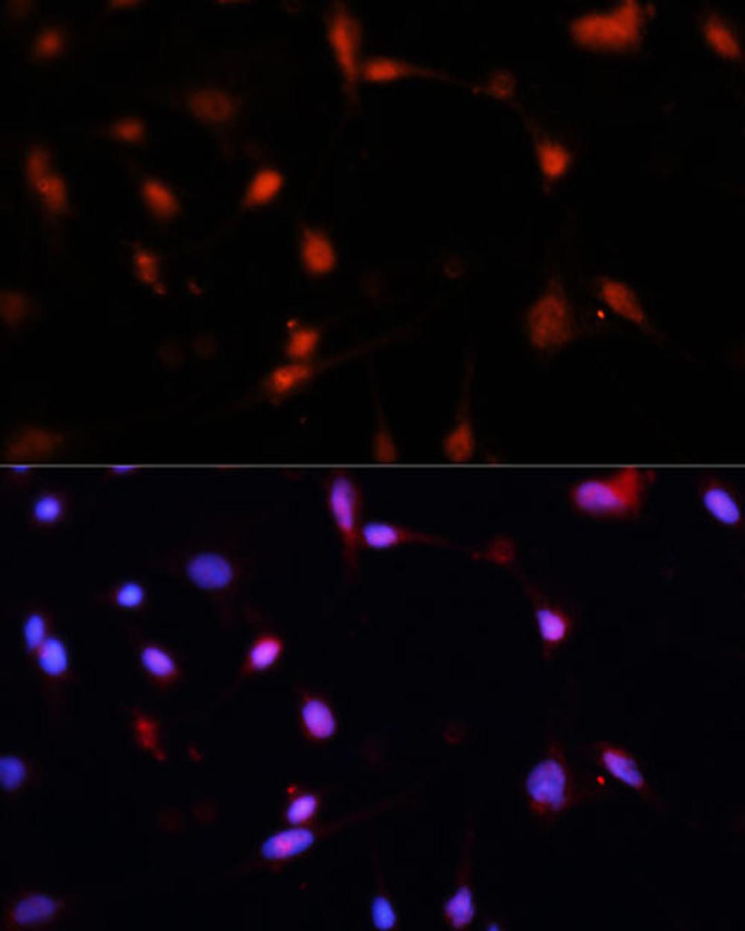 Immunofluorescence - ESR1 antibody (A16668)