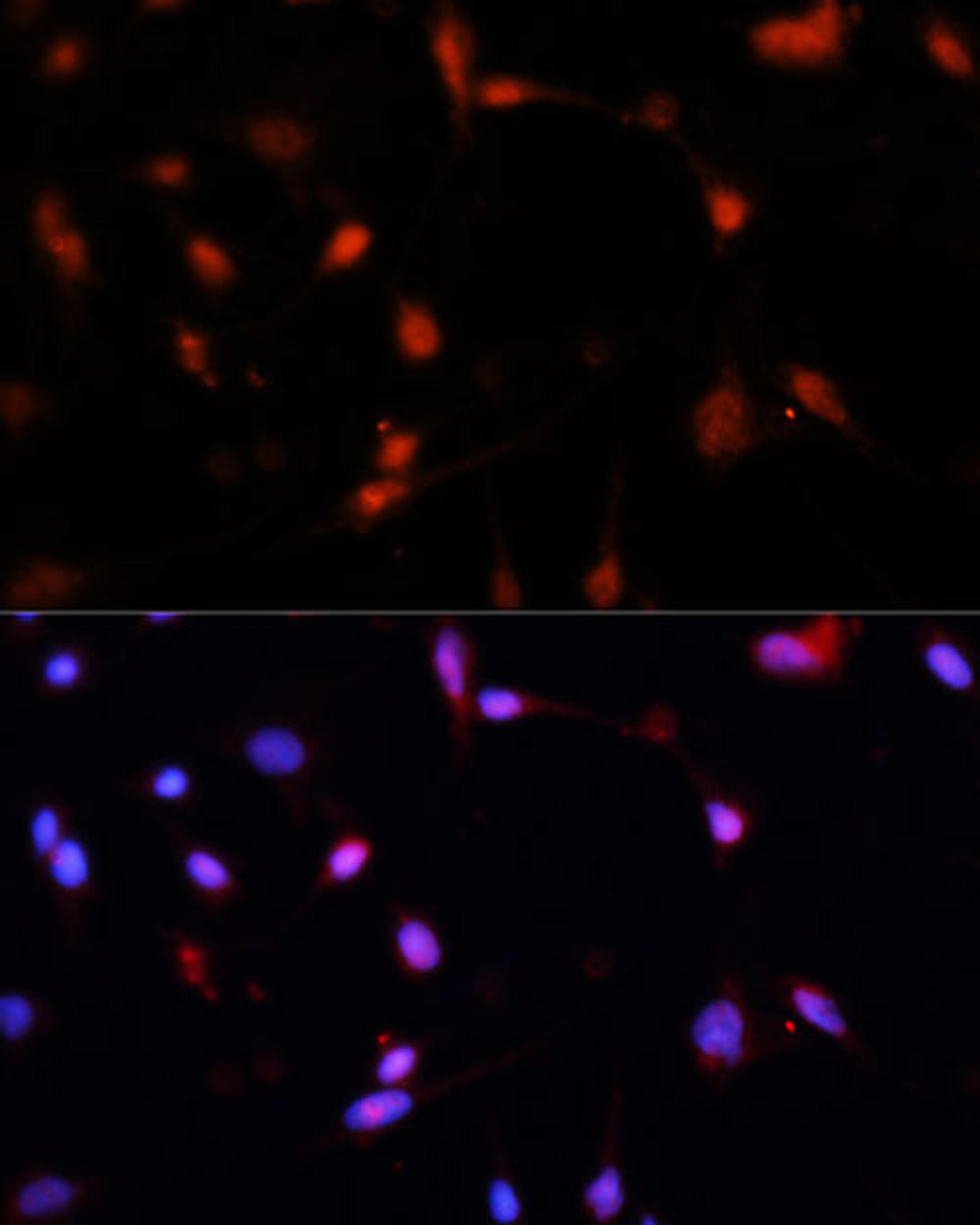 Immunofluorescence - ESR1 antibody (A16668)