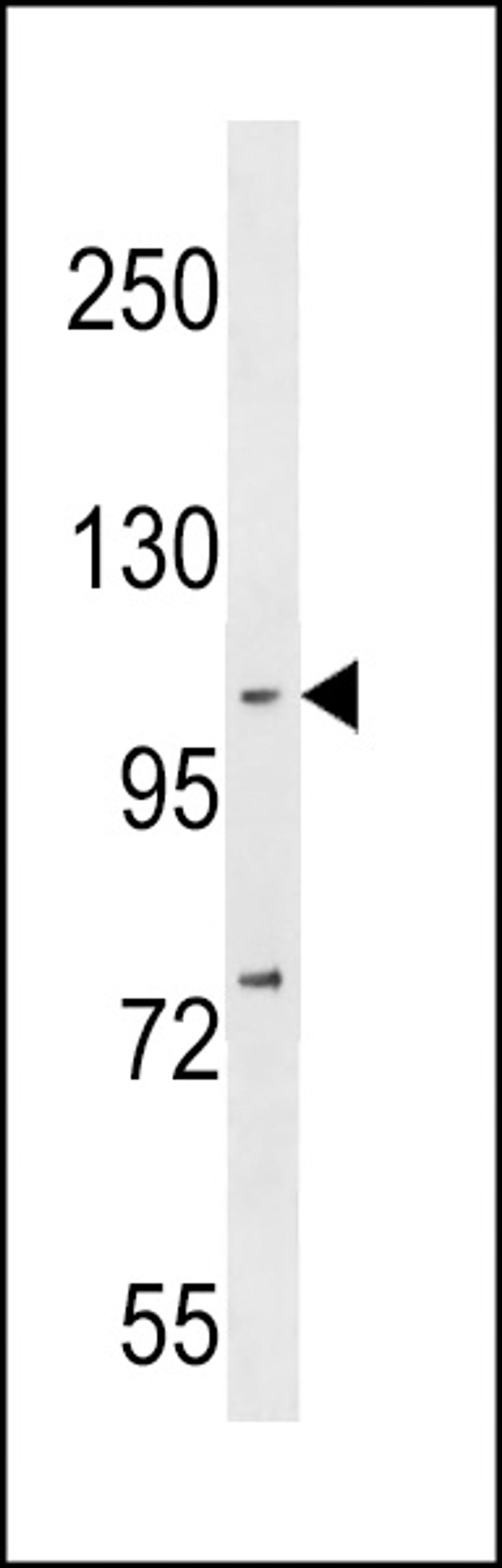 Western blot analysis in MDA-MB231 cell line lysates (35ug/lane).This demonstrates the NFKB antibody detected the NFKB protein (arrow).