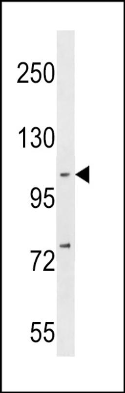 Western blot analysis in MDA-MB231 cell line lysates (35ug/lane).This demonstrates the NFKB antibody detected the NFKB protein (arrow).