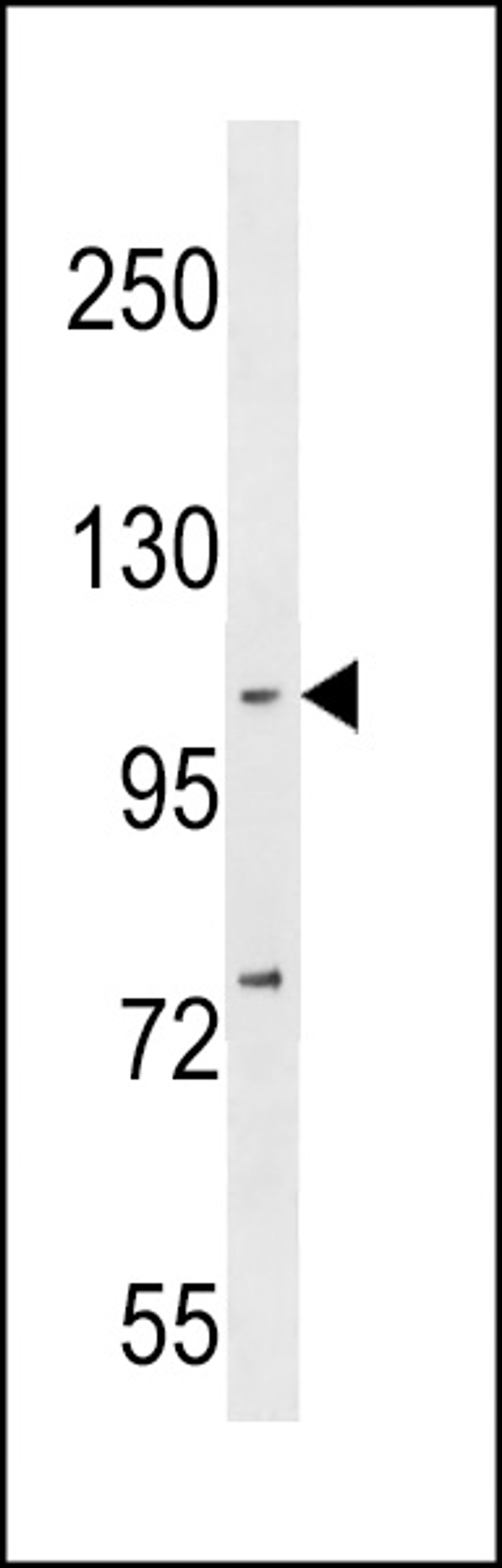 Western blot analysis in MDA-MB231 cell line lysates (35ug/lane).This demonstrates the NFKB antibody detected the NFKB protein (arrow).