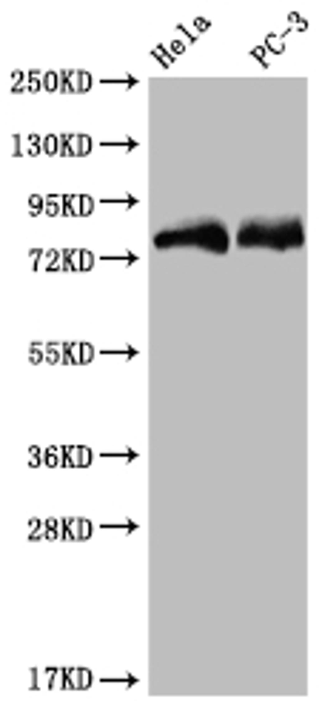 Western Blot. Positive WB detected in: Hela whole cell lysate, PC3 whole cell lysate. All lanes: SENP1 antibody at 1:2000. Secondary. Goat polyclonal to rabbit IgG at 1/50000 dilution. Predicted band size: 74 kDa. Observed band size: 72-95 kDa. 