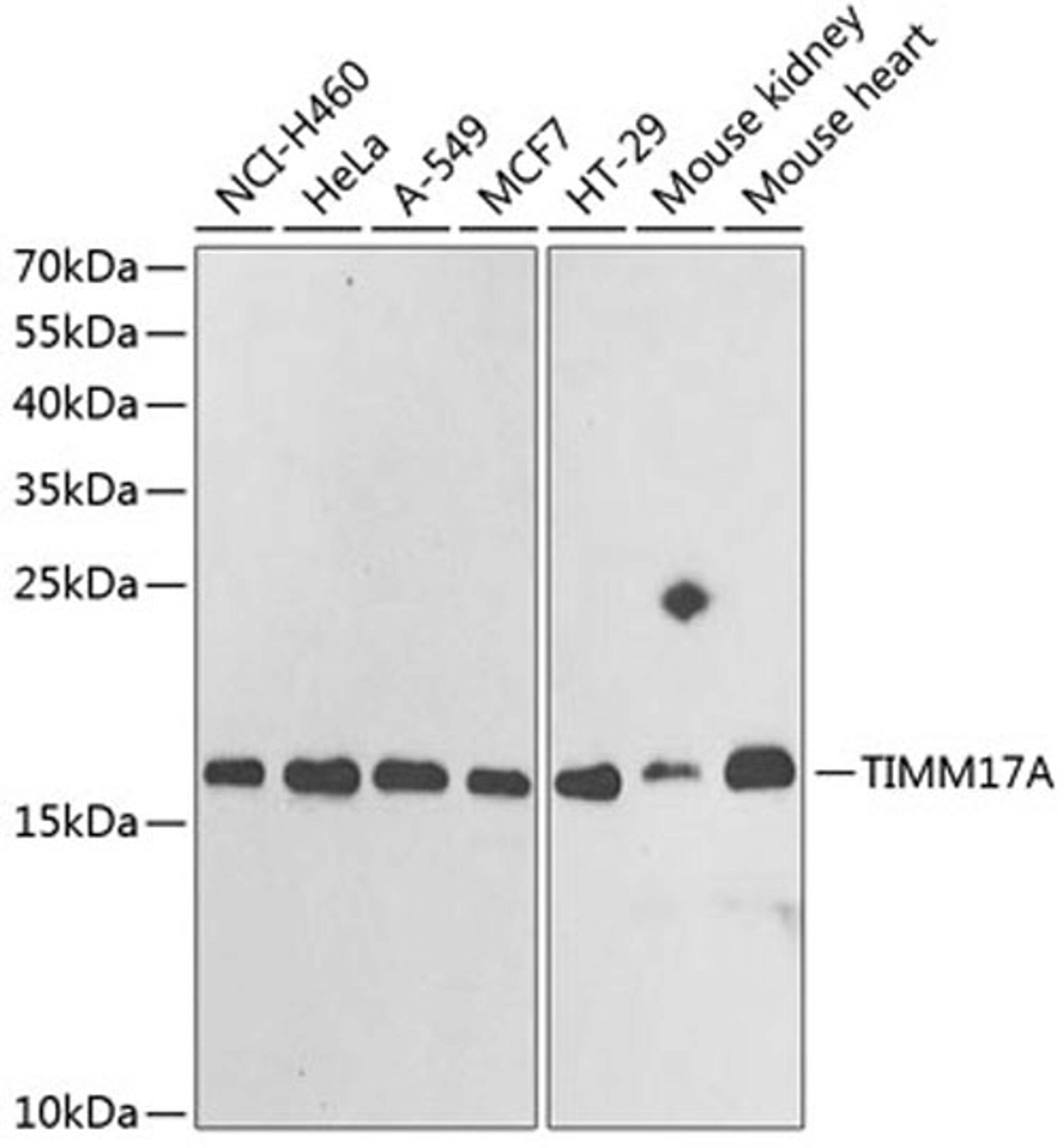 Western blot - TIMM17A antibody (A6449)