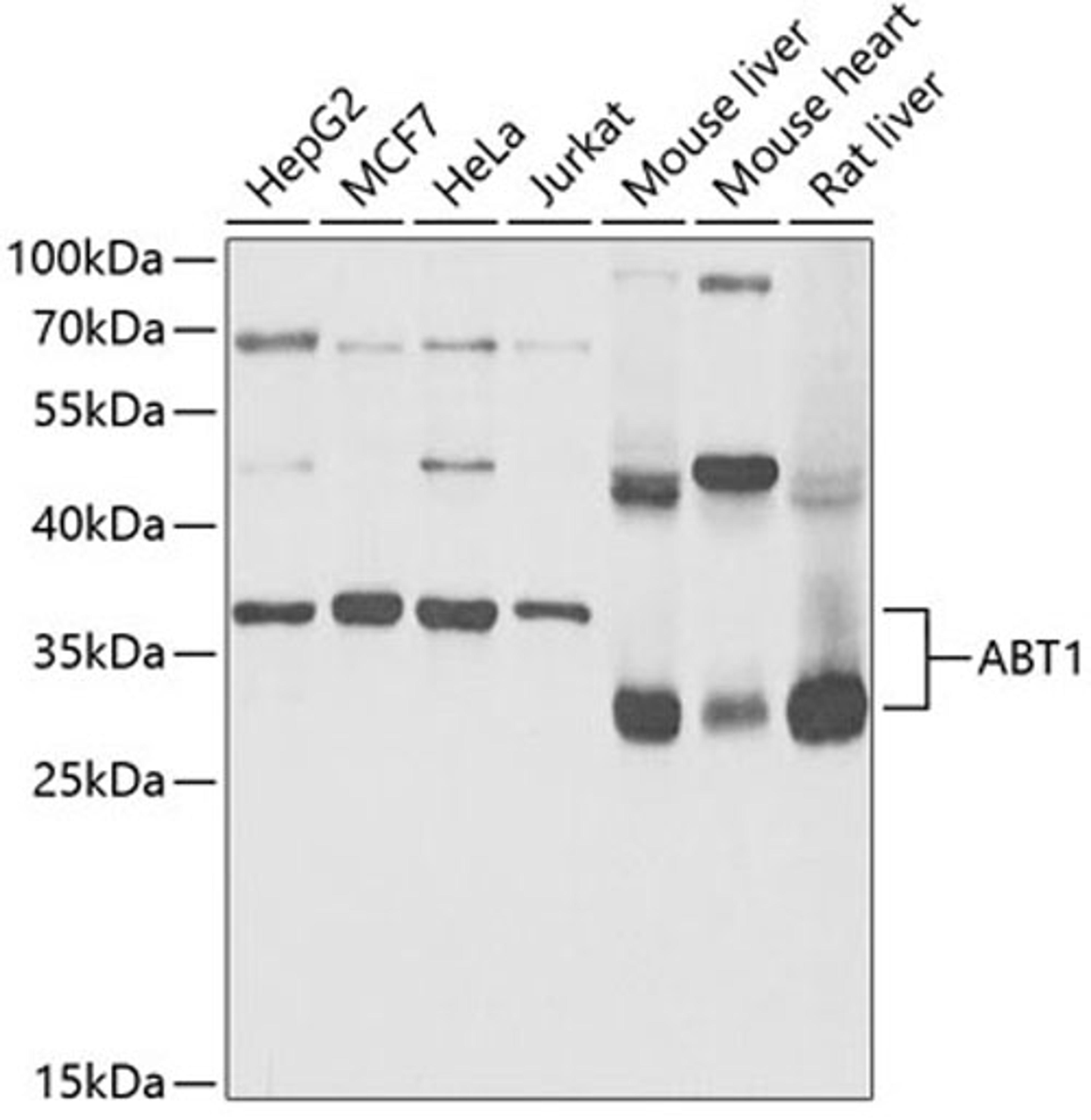 Western blot - ABT1 antibody (A5898)