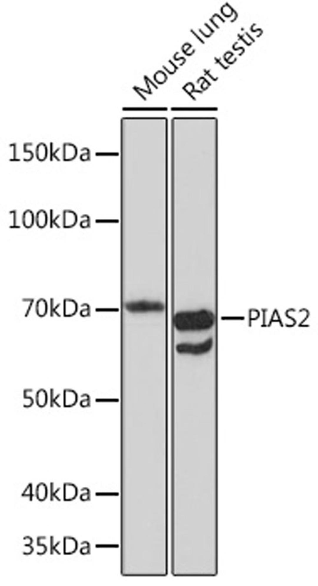 Western blot - PIAS2 Rabbit mAb (A5203)