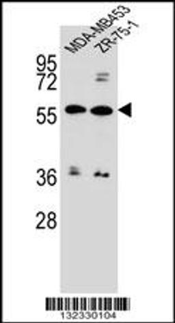 Western blot analysis in MDA-MB453,ZR-75-1 cell line lysates (35ug/lane).