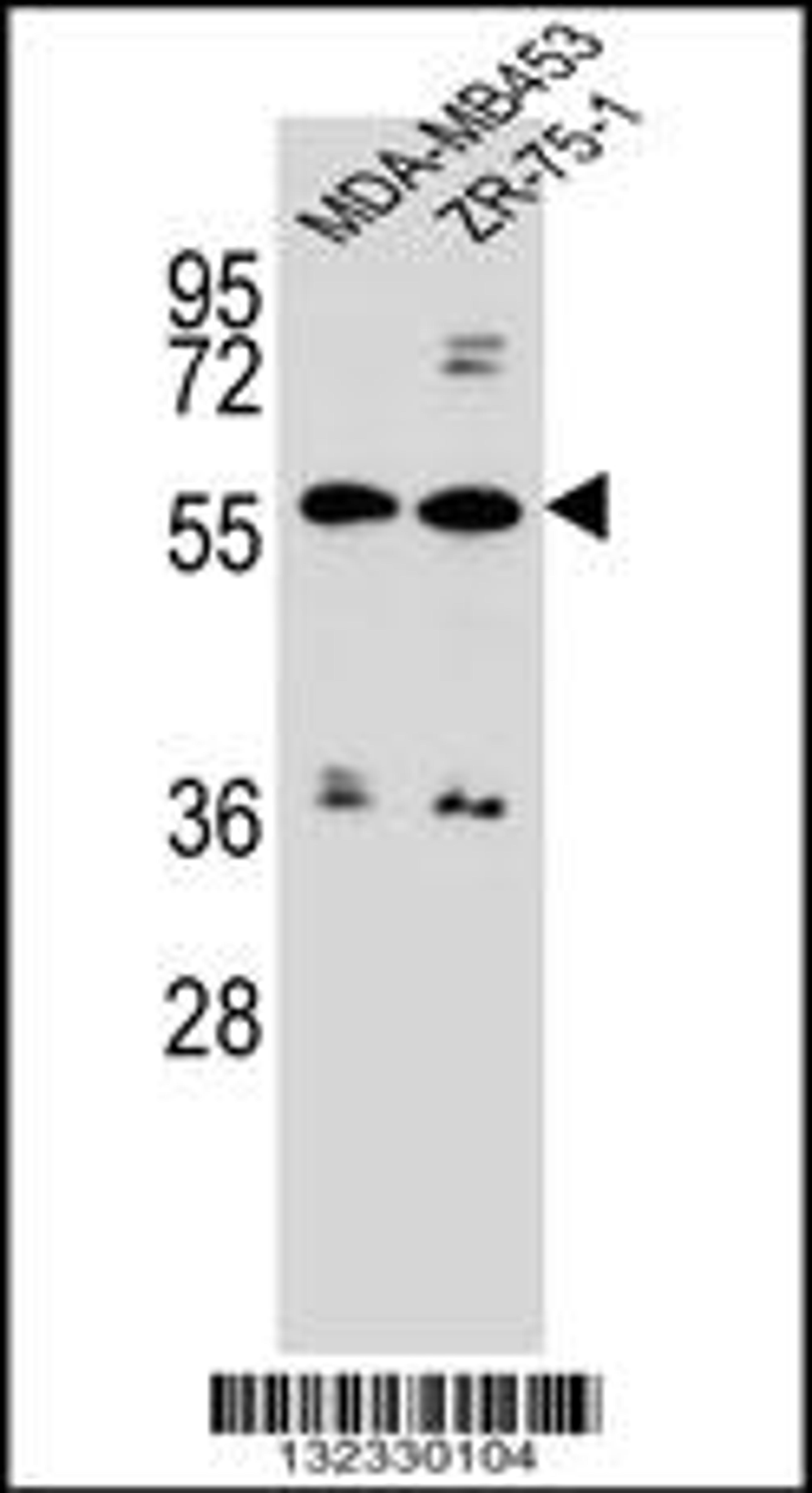 Western blot analysis in MDA-MB453,ZR-75-1 cell line lysates (35ug/lane).